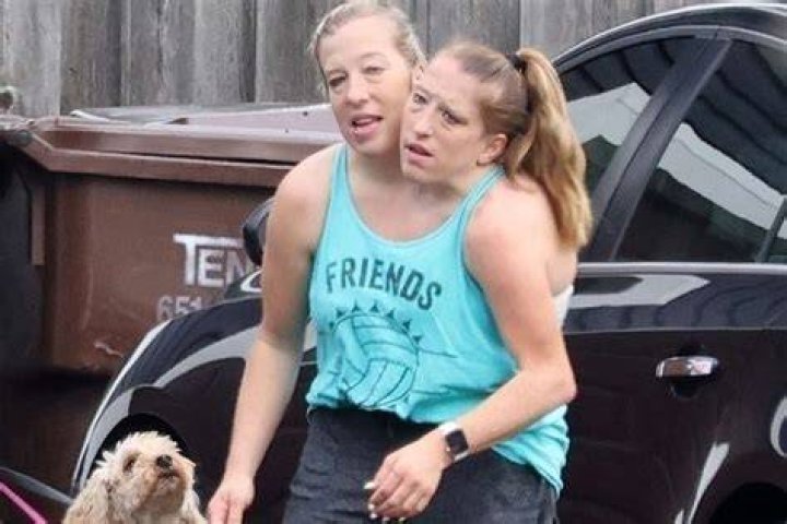 Abby and Brittany Hensel Family Tragedy: A Heartfelt Story of Strength and Resilience