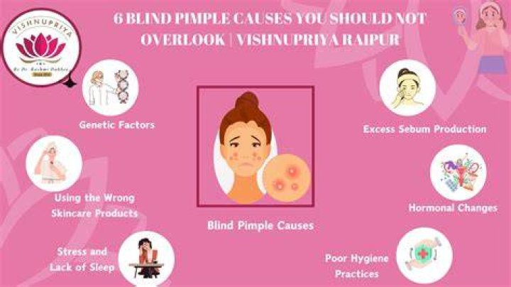 Anatomy of a Blind Pimple: Understanding Causes, Treatments, and Prevention