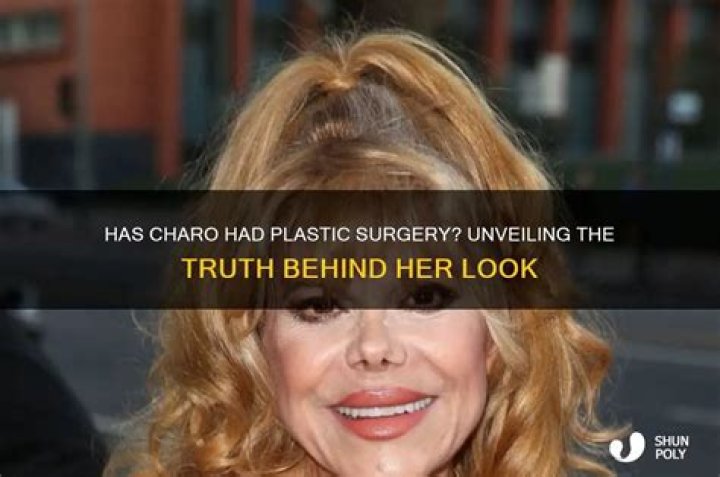 Bianca Censory: Has She Had Plastic Surgery? Unveiling the Truth