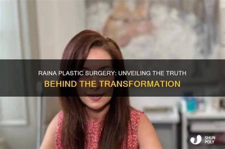 Bianca Censوري: Unveiling the Truth Behind Her Plastic Surgery Journey