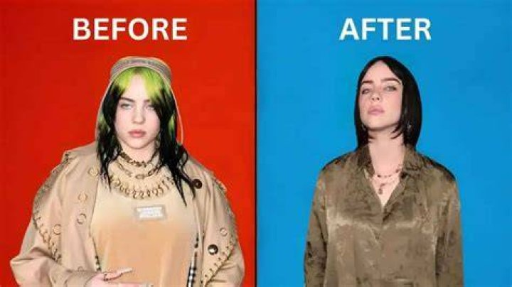 Billie Eilish Breast Reduction: Facts, Truths, and Insights