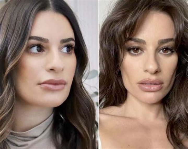 Buccal Fat Removal Celebs: The Ultimate Guide to Understanding and Transforming Facial Contours