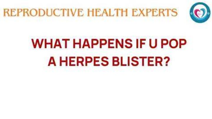 Can You Pop a Herpes Blister? Understanding the Risks and Proper Care