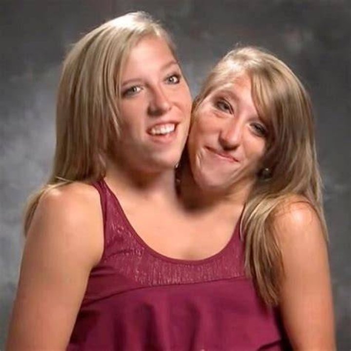 Did Abby and Brittany Hensel Pass Away? Exploring the Lives and Legacy of the Famous Conjoined Twins