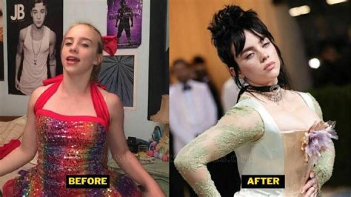 Did Billie Eilish Have a Breast Reduction? Exploring the Facts and Addressing the Rumors