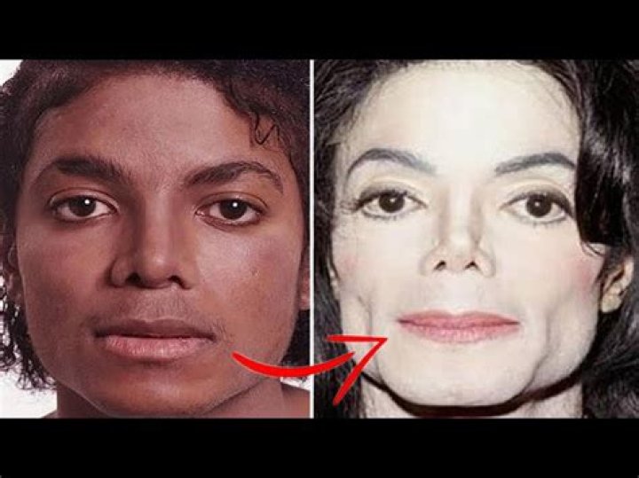 Did Michael Jackson Change His Skin Colour? Unveiling the Truth