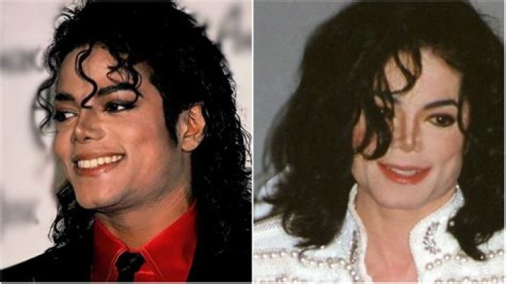 Did MJ Bleach His Skin? Unveiling the Truth Behind Michael Jackson's Transformation