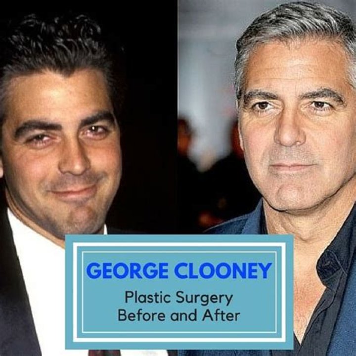 George Clooney Plastic Surgery: Debunking the Myths and Understanding the Truth
