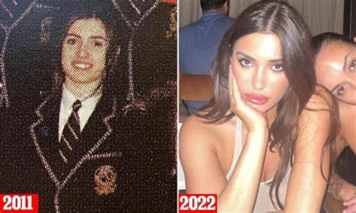 Has Bianca Censori Had Plastic Surgery? The Truth Behind the Rumors