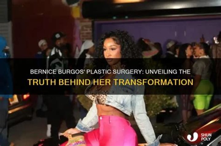 Has Bianca Had Plastic Surgery? Unveiling the Truth Behind Her Transformation