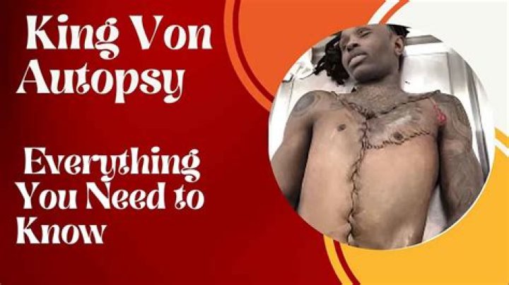 King Von Dead Body Pic: A Comprehensive Exploration and Understanding