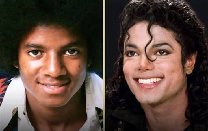 Michael Jackson Before and After: A Comprehensive Look at the King of Pop's Transformation