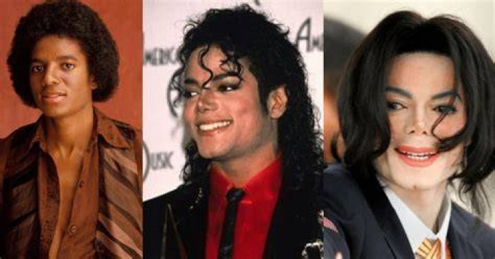 Michael Jackson's Condition: The Truth Behind the Icon's Health Journey