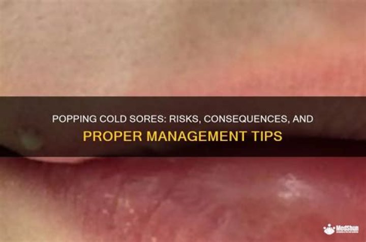 Popping Herpes: Understanding the Risks, Symptoms, and Proper Management