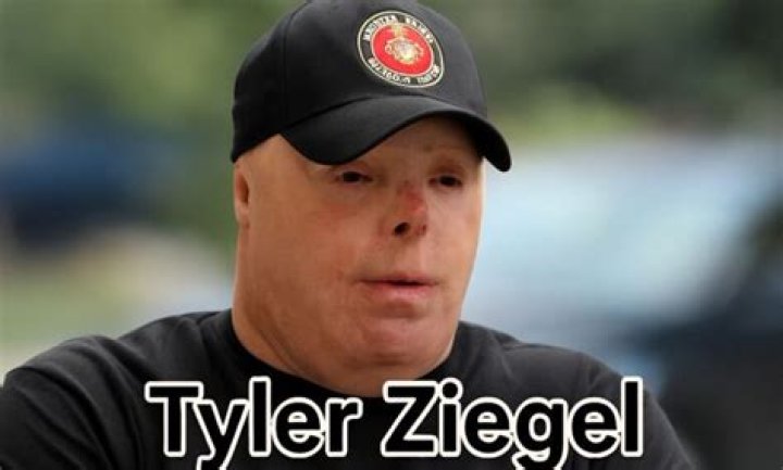 Tyler Ziegel: A Comprehensive Look into the Life, Career, and Achievements