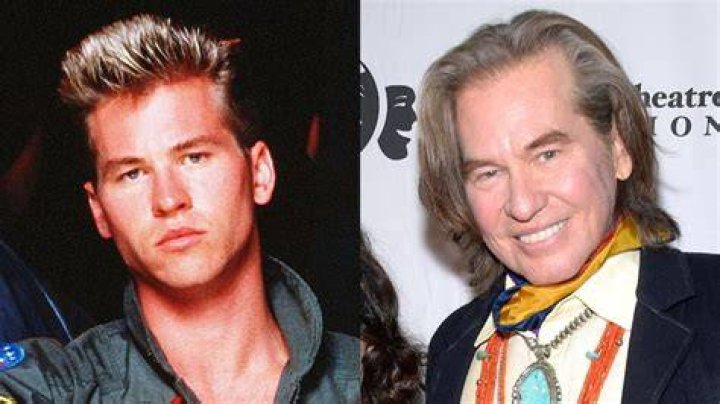 Val Kilmer's Health Condition: A Comprehensive Overview