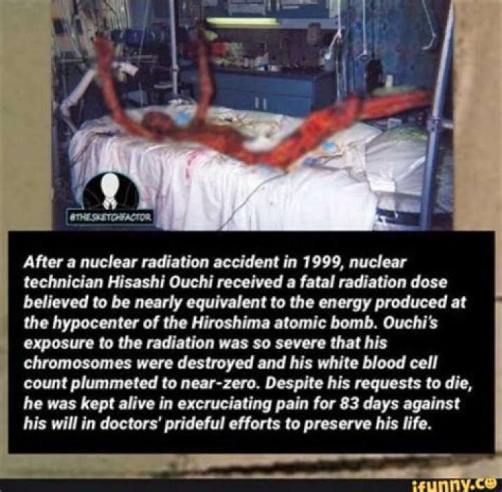 What Happened to Hisashi Ouchi: A Comprehensive Analysis of a Tragic Event